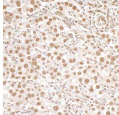 Immunohistochemistry-Paraffin: SMC1 [p Ser966] Antibody [NB100-206]